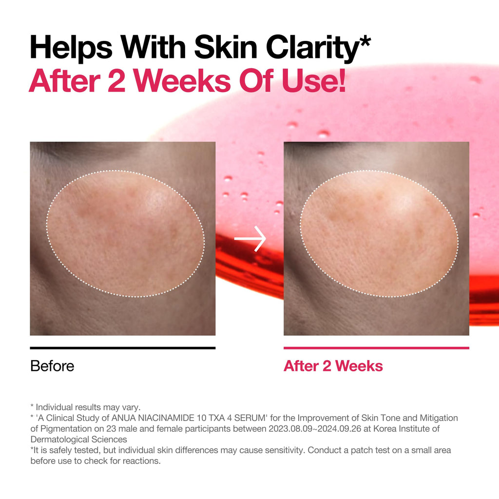 ANUA Niacinamide 10 + TXA 4 Serum, Hyaluronic Acid, Tranexamic acid, Facial Serum for Glass Skin, Clarifying, Radiant Complexion with Natural Color, Korean Skin Care (30ml /1.01 fl.oz)