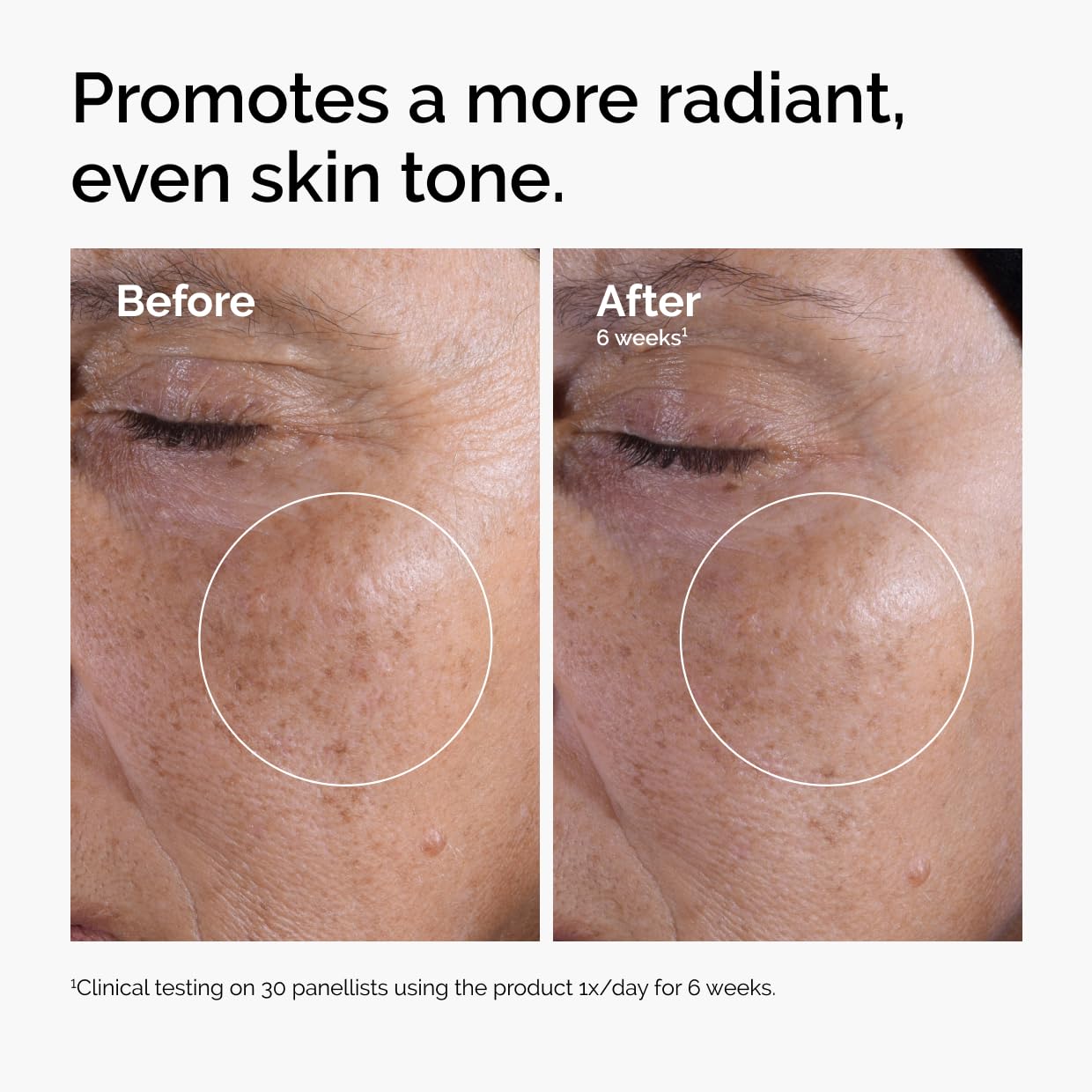 The Ordinary Glycolic Acid 7% Exfoliating Toner, Brightening and Smoothing Daily Toner for More Even-Looking Skin Tone, 3.4 Fl Oz