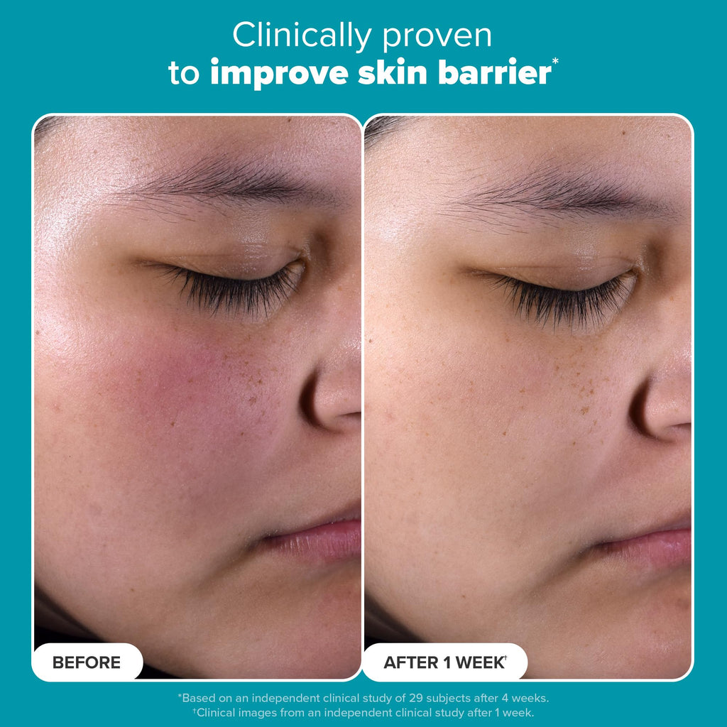 Paulas Choice--SKIN PERFECTING 2% BHA Liquid Salicylic Acid Exfoliant--Facial Exfoliant for Blackheads, Enlarged Pores, Wrinkles & Fine Lines, 4 oz Bottle